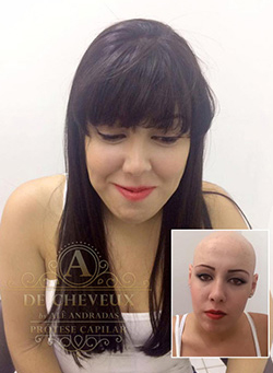 Cliente utilizando protese capilar De Cheveux