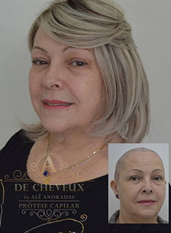 Cliente utilizando protese capilar De Cheveux